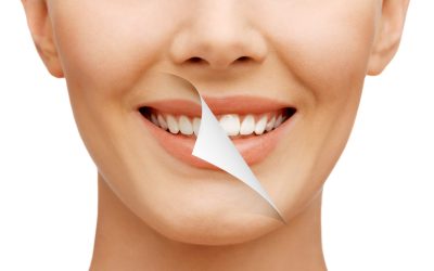 From Stained to Stunning: The Power of Teeth Whitening